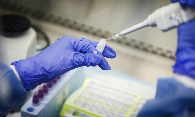 ΗΠΑ: Εγκρίθηκαν τεστ για την ανίχνευση του κορονοϊού