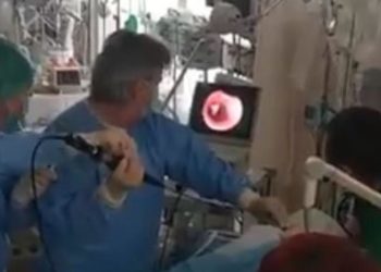 Πάτρα: Συγκλονιστικό βίντεο από την αφαίρεση καρυδιού από τον πνεύμονα 10μηνου βρέφους