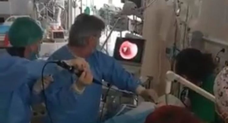Πάτρα: Συγκλονιστικό βίντεο από την αφαίρεση καρυδιού από τον πνεύμονα 10μηνου βρέφους