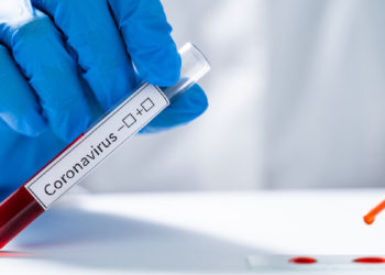 ΕΟΔΥ: Από αύριο εξετάσεις για τον κορονοϊό σε 16 νησιά του Αιγαίου