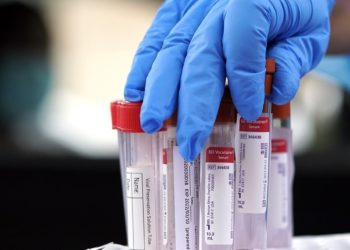 Κορονοϊός: 28 νέα κρούσματα το τελευταίο 24ωρο