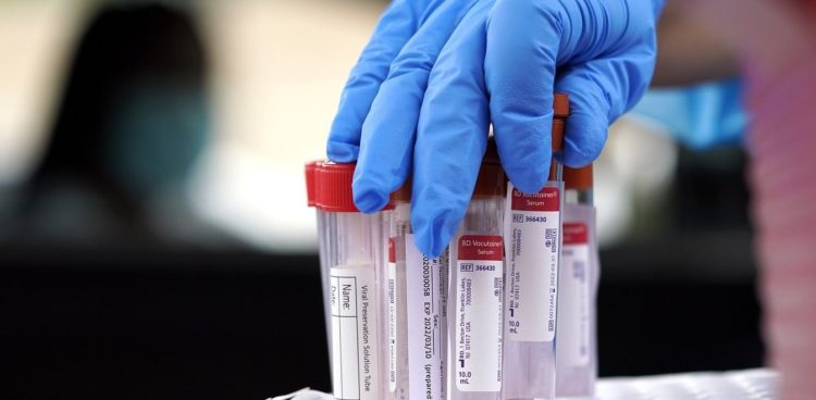 Κορονοϊός: 28 νέα κρούσματα το τελευταίο 24ωρο