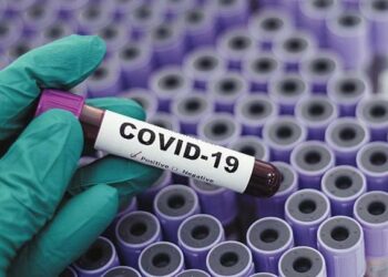 Κορονοϊός: 151 κρούσματα σήμερα στην Ελλάδα – Κανένας θάνατος