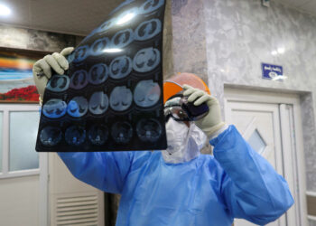 Κορoνοϊός: Στα 157 τα νέα κρούσματα – Δύο θάνατοι