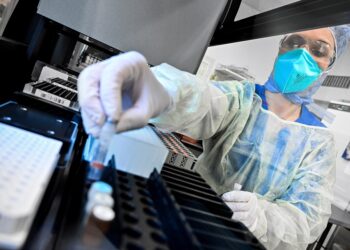 Κορoνοϊός: Στα 157 τα νέα κρούσματα – Δύο θάνατοι