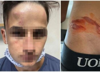 Γαλάτσι: Συμμορία 20 ανηλίκων ξυλοκόπησε άγρια 17χρονο