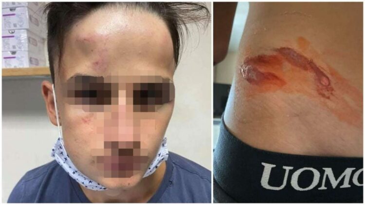 Γαλάτσι: Συμμορία 20 ανηλίκων ξυλοκόπησε άγρια 17χρονο