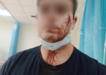 Μενίδι: Άγρια επίθεση αστυνομικών από Ρομά