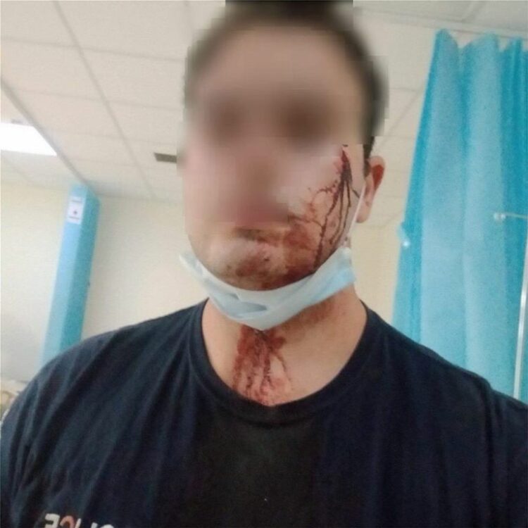 Μενίδι: Άγρια επίθεση αστυνομικών από Ρομά