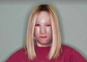 Αννίτα Ναθαναήλ: «Το τελευταίο χειρουργείο της Ιωάννας Παλιοσπύρου δεν πήγε καλά»