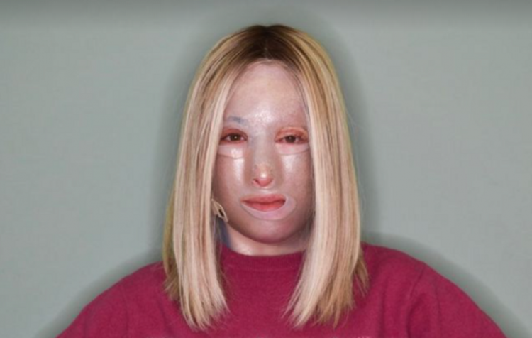 Αννίτα Ναθαναήλ: «Το τελευταίο χειρουργείο της Ιωάννας Παλιοσπύρου δεν πήγε καλά»