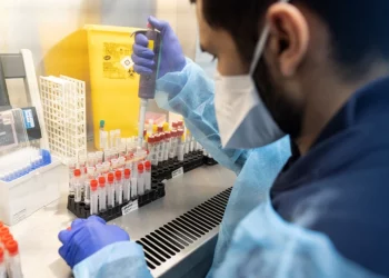 ΠΟΥ: Η εξάπλωση της ευλογιάς των πιθήκων ίσως επιταχυνθεί το καλοκαίρι