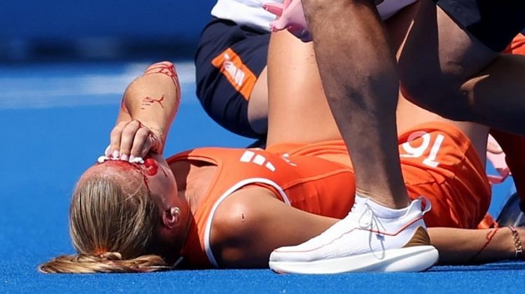 Ολυμπιακοί Αγώνες: Σοκαριστικός τραυματισμός της Μπεργκ στον ημιτελικό του χόκεϊ