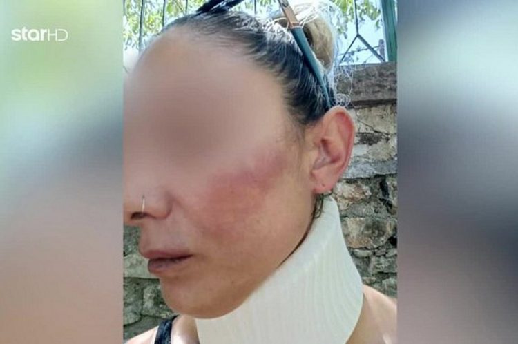 Λέσβος: Συνελήφθη ο πυροσβέστης που κατηγορείται ότι ξυλοκόπησε τη σύντροφό του μπροστά στο παιδί τους