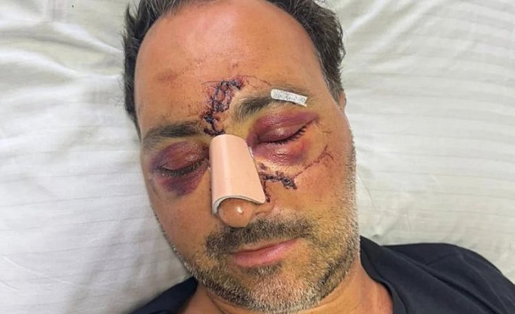 Ηράκλειο: Παραδόθηκαν δύο άτομα για τον ξυλοδαρμό του Ελληνοκαναδού