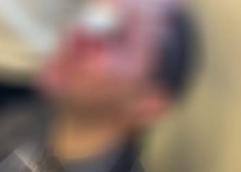 Επίθεση στη Νομική Αθηνών: «Μία έγκυος υπέστη σοκ»