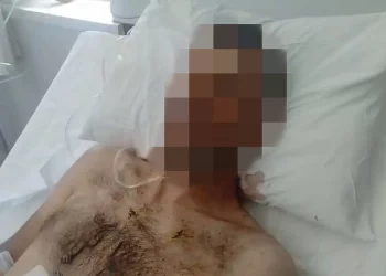 Λέσβος: Εκτός κινδύνου ο 35χρονος που δέχθηκε 18 μαχαιριές – Πατέρας θύματος: «Ήθελε να τον καθαρίσει, μάλλον για γυναίκα»