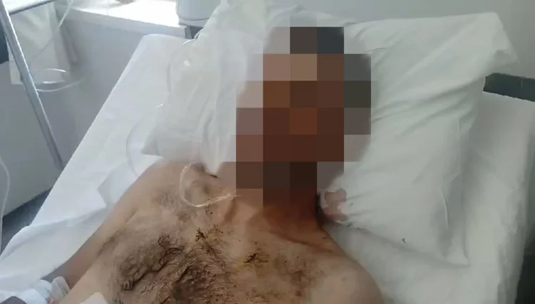 Λέσβος: Εκτός κινδύνου ο 35χρονος που δέχθηκε 18 μαχαιριές – Πατέρας θύματος: «Ήθελε να τον καθαρίσει, μάλλον για γυναίκα»