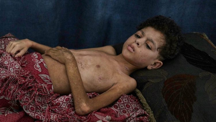 AP Photo/Jehad Alshrafi